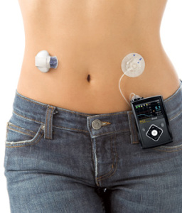 MiniMed-640G-Torso-Shot-High-Res_300px